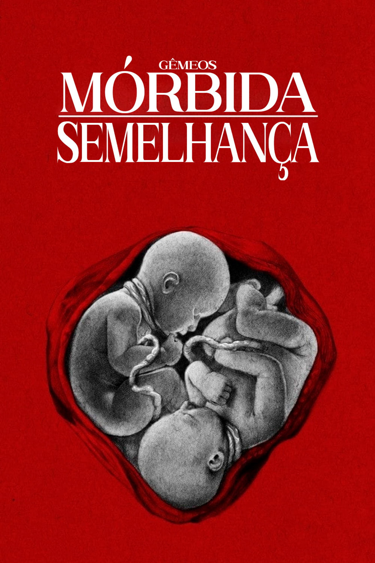Pôster de Gêmeos: Mórbida Semelhança