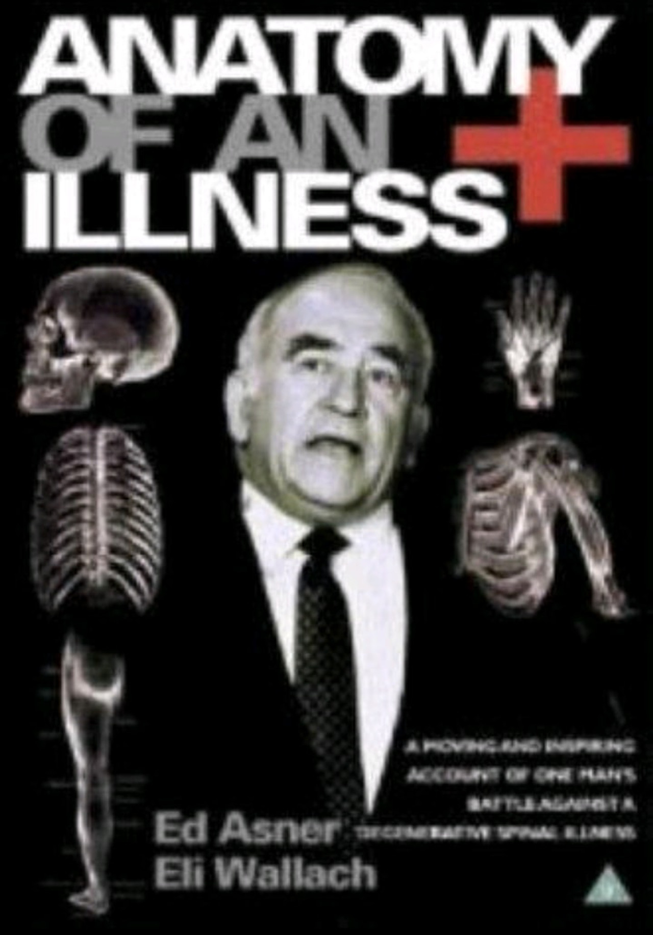 Pôster de Anatomy of an Illness